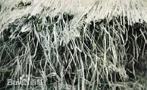 郑士龙前后照片