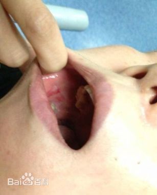 肖肖展示受伤照片素颜照壁纸