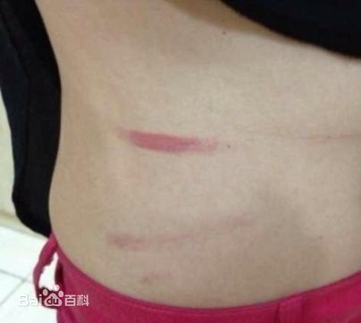 肖肖展示受伤照片素颜照壁纸