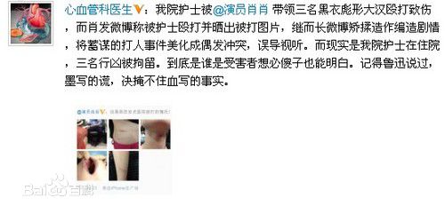 最全肖肖素颜照