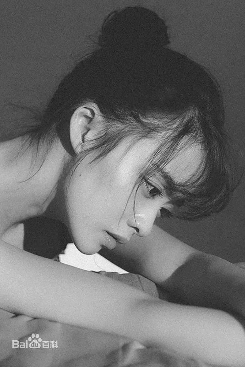 余心恬(Vicky)前后照片