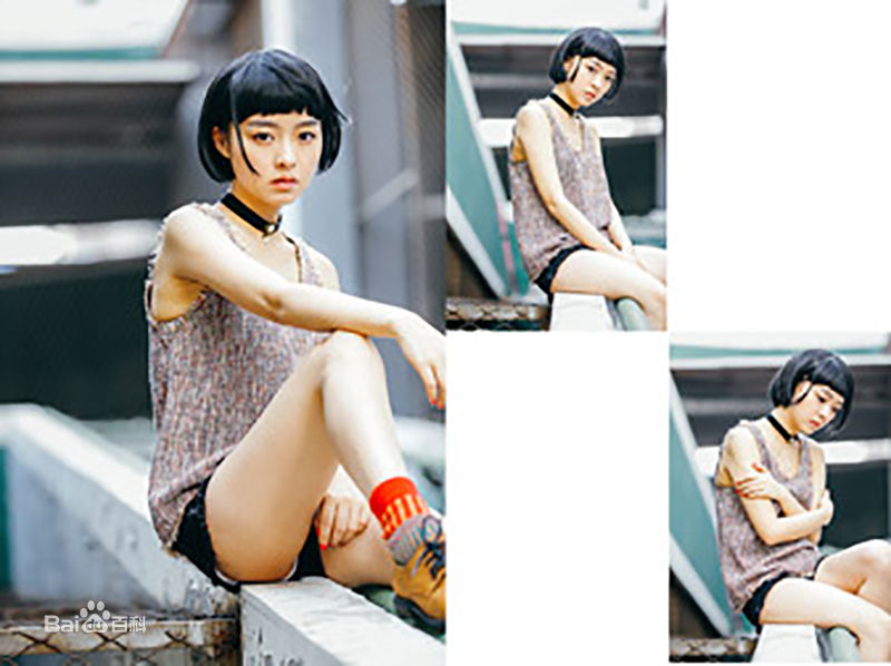 余心恬(Vicky)前后照片