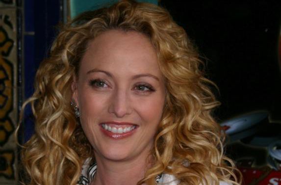 维吉妮娅·马德森(Virginia Madsen)前后照片