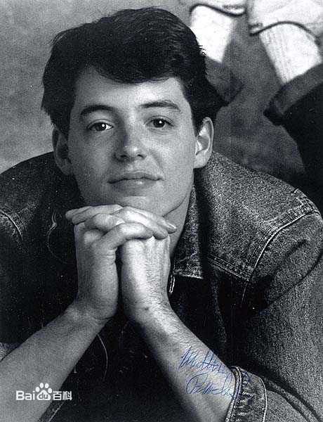 马修·布罗德里克(Matthew Broderick)前后照片