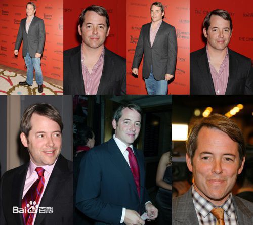 马修·布罗德里克(Matthew Broderick)前后照片