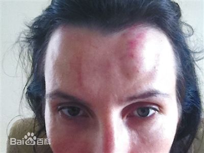 《李阳》封面图片