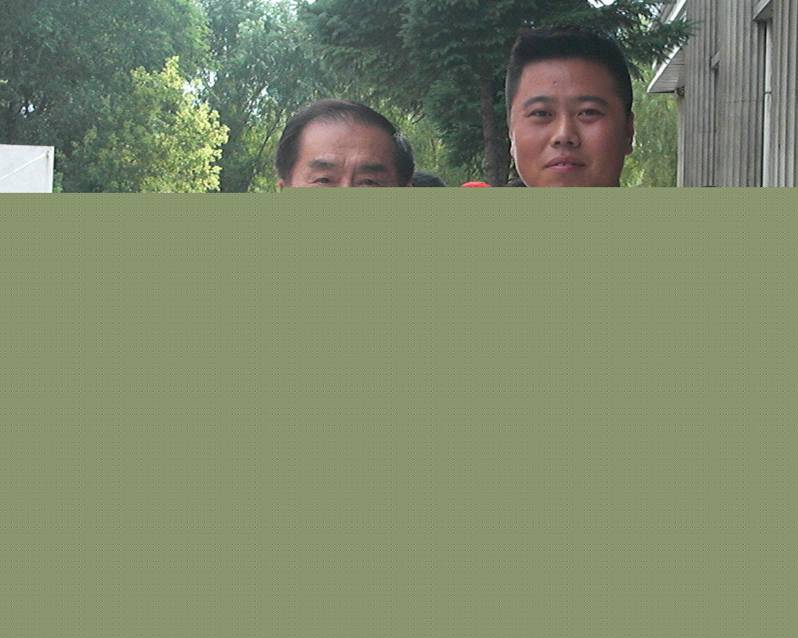 郝爱民先生前后照片