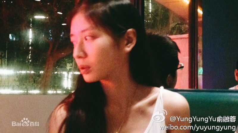 俞融蓉前后照片