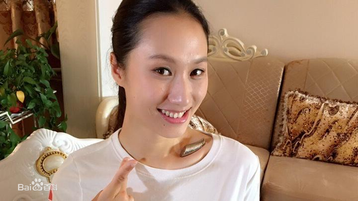 张虹生活照片前后照片