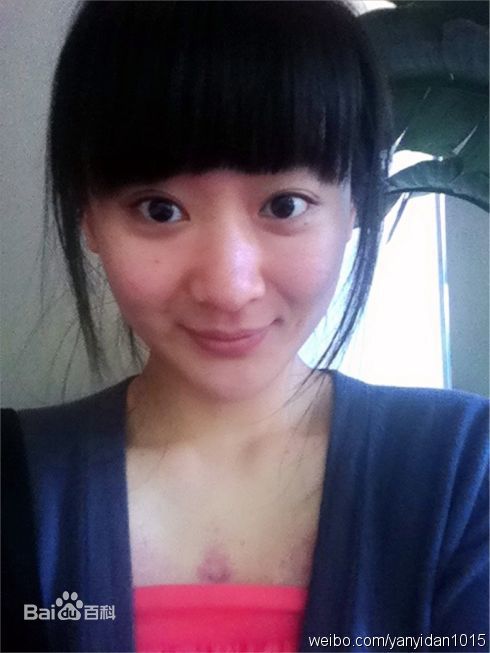 严艺丹(ivyan)前后照片