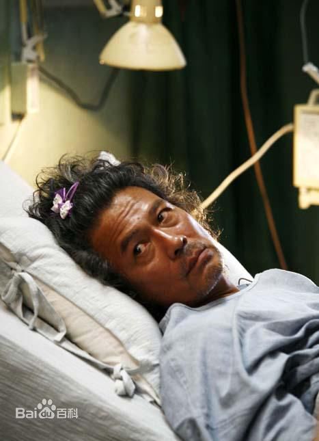 罗美兰()前后照片