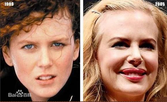 精选妮可·基德曼(Nicole Kidman)精彩图册