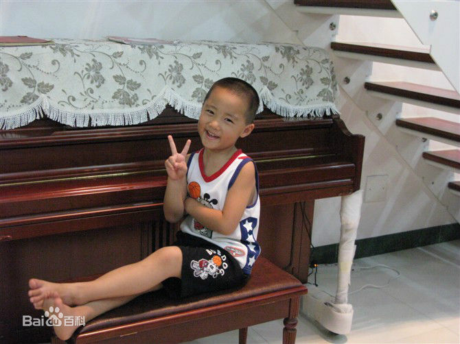 冯邵一(Johnny)童年照前后照片