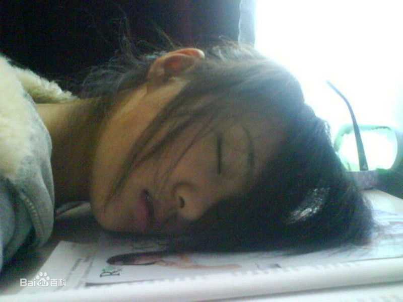 郑爽(Zheng Shuang)早期前后照片