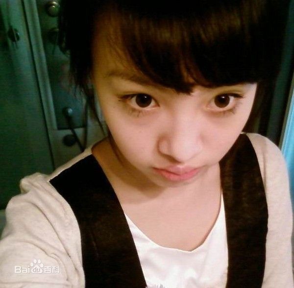 郑爽(Zheng Shuang)早期前后照片