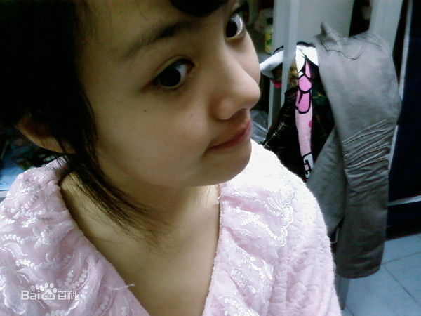 郑爽(Zheng Shuang)早期前后照片