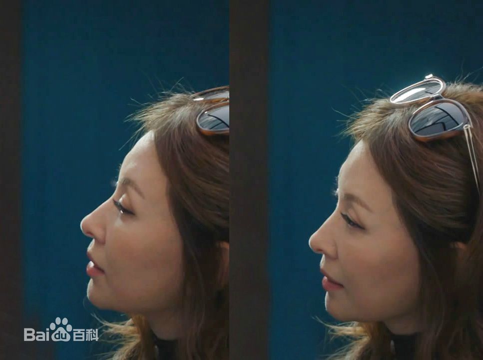 李美淑(，Lee Mi Sook)电视剧：爱情的温度性感图片图集