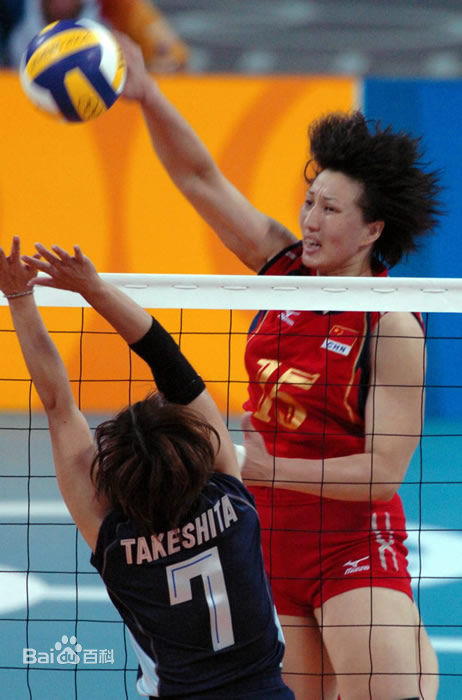 王丽娜前后照片