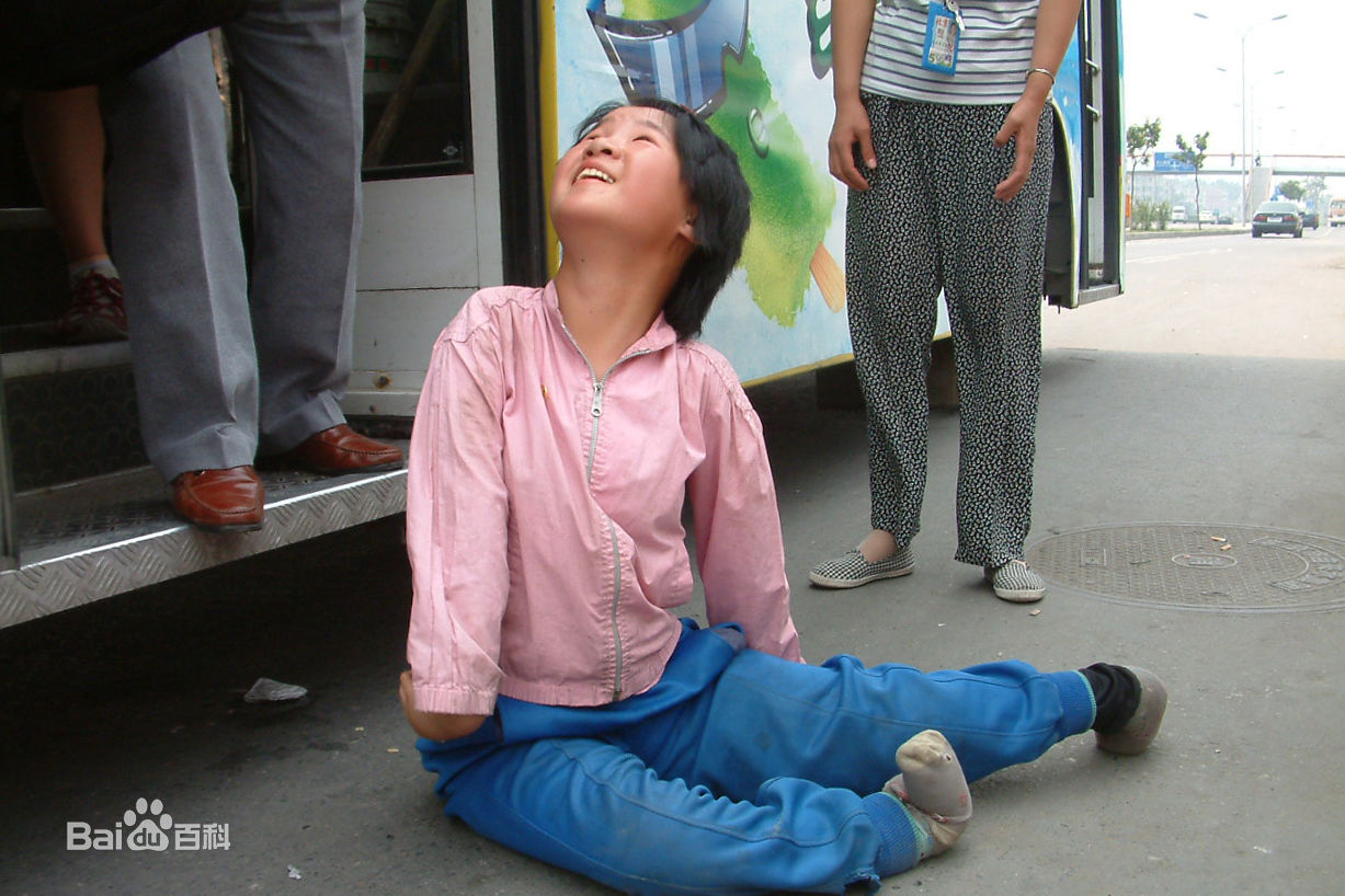 张仁杰(renjiezhang)跟踪拍摄王雪萍十多年的生活照片。性感图片图集