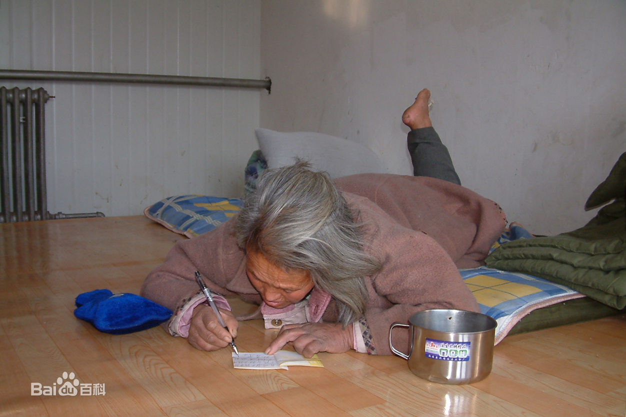 张仁杰(renjiezhang)帮助流浪奶奶寻家的前后照片。前后照片