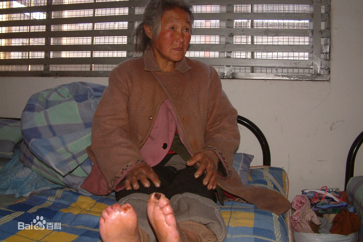 张仁杰(renjiezhang)帮助流浪奶奶寻家的前后照片。前后照片