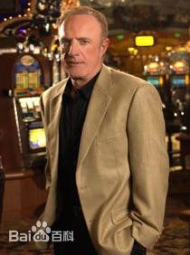 詹姆斯·凯恩(James Caan)前后照片