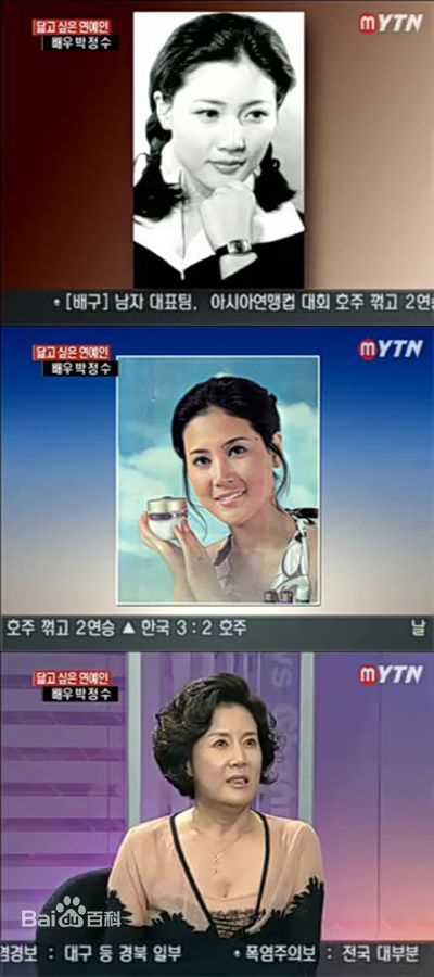 朴贞秀()早期照片素颜照相册