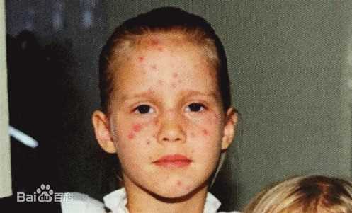 克莱尔·霍尔特(Claire Holt)童年的生活照相册