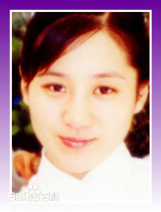 庞赛男(selena)前后照片