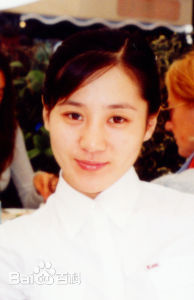 庞赛男(selena)前后照片