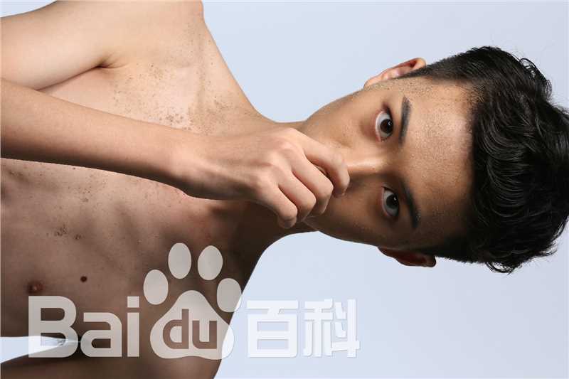 高俊杰(Shine)前后照片