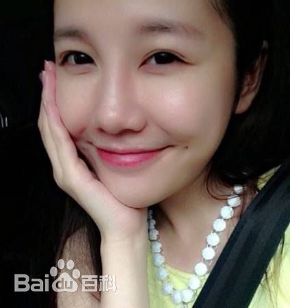 刘语熙(rachel)前后照片