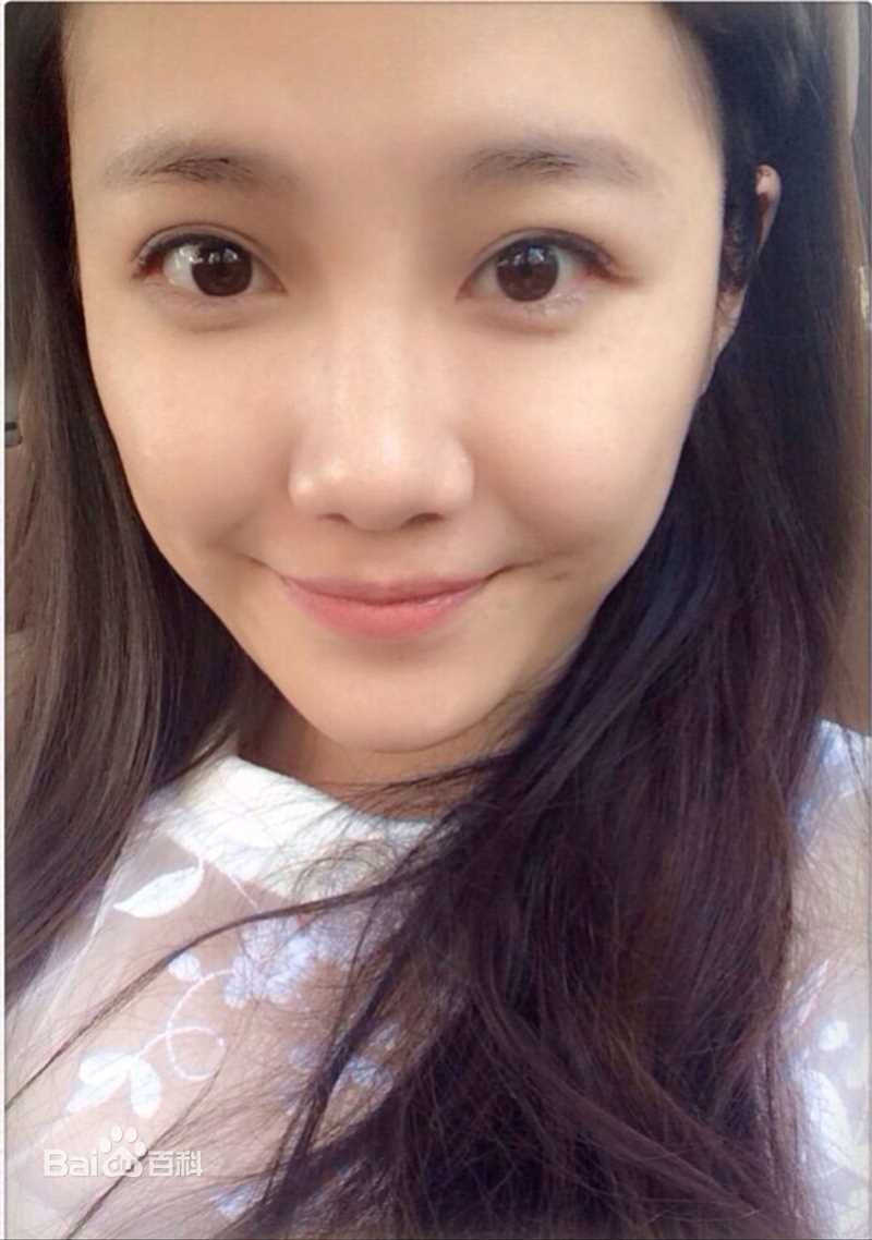 刘语熙(rachel)前后照片