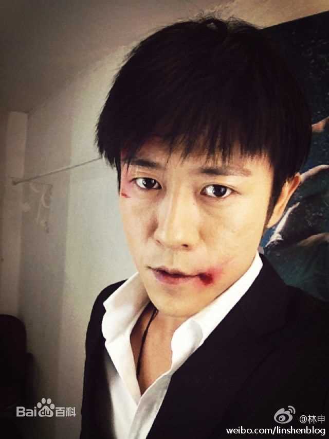 林雨申前后照片