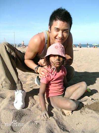 胡兵荧屏照前后照片