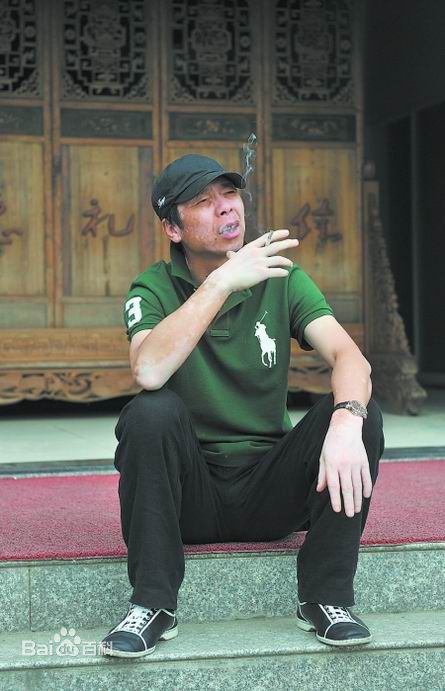 冯小刚(Xiaogang Feng)前后照片