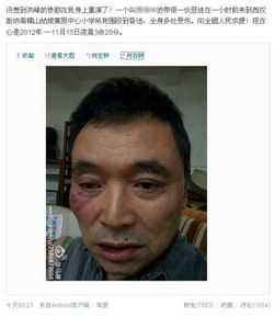 马原遭殴打前后照片