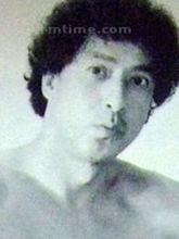 伊雷(James Yi Lui)前后照片