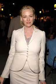 维吉妮娅·马德森(Virginia Madsen)前后照片