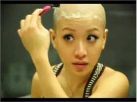 俞融蓉前后照片